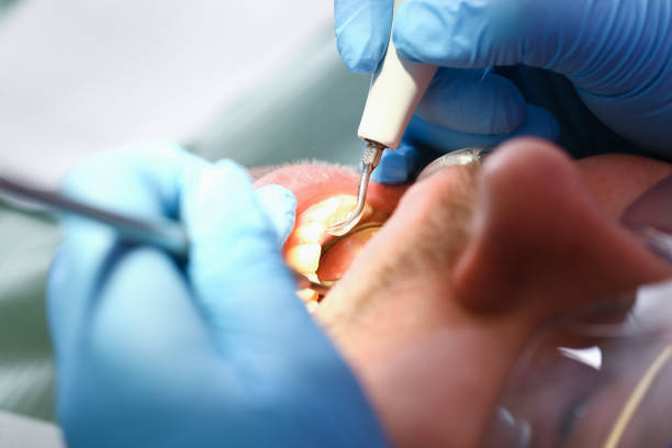 Best Pediatric Emergency Dentist in Albany, TX