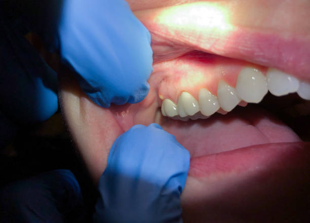 Best Emergency Dental Services for Seniors in Albany, TX